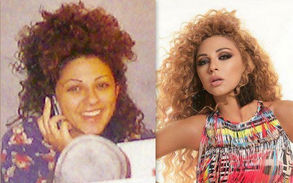 Arab Celebrities Before After